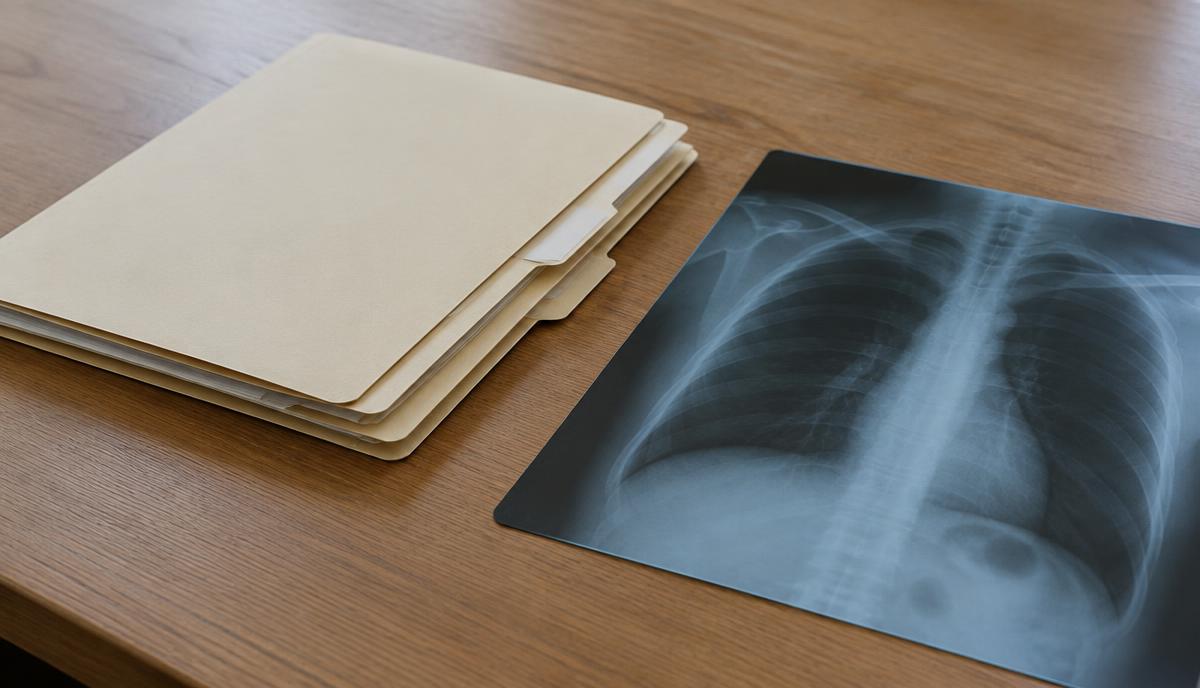 Carpetas de expediente médico cerradas y una radiografía sobre una mesa de trabajo, sin texto legible